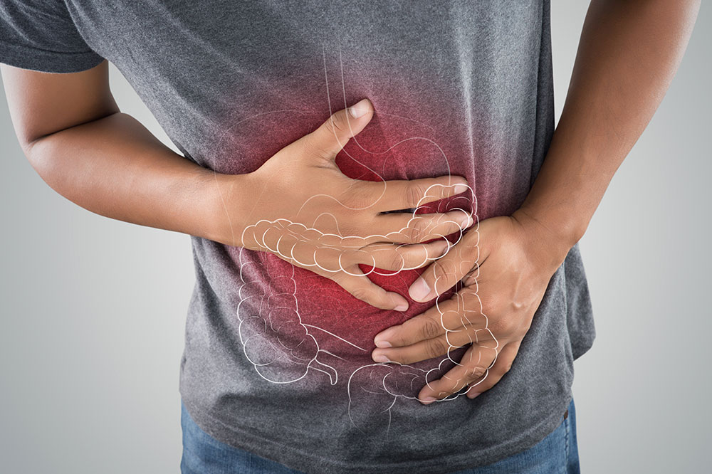 Colon Cancer – Causes and Risk Factors
