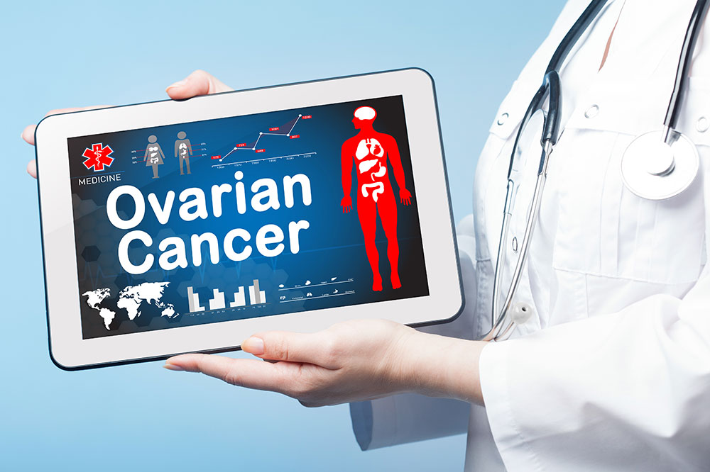 Detection and Treatment of Ovarian Cancer