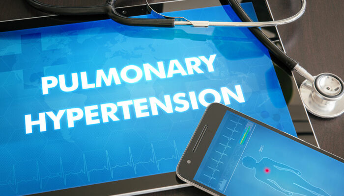 Effective Treatment Options For PAH