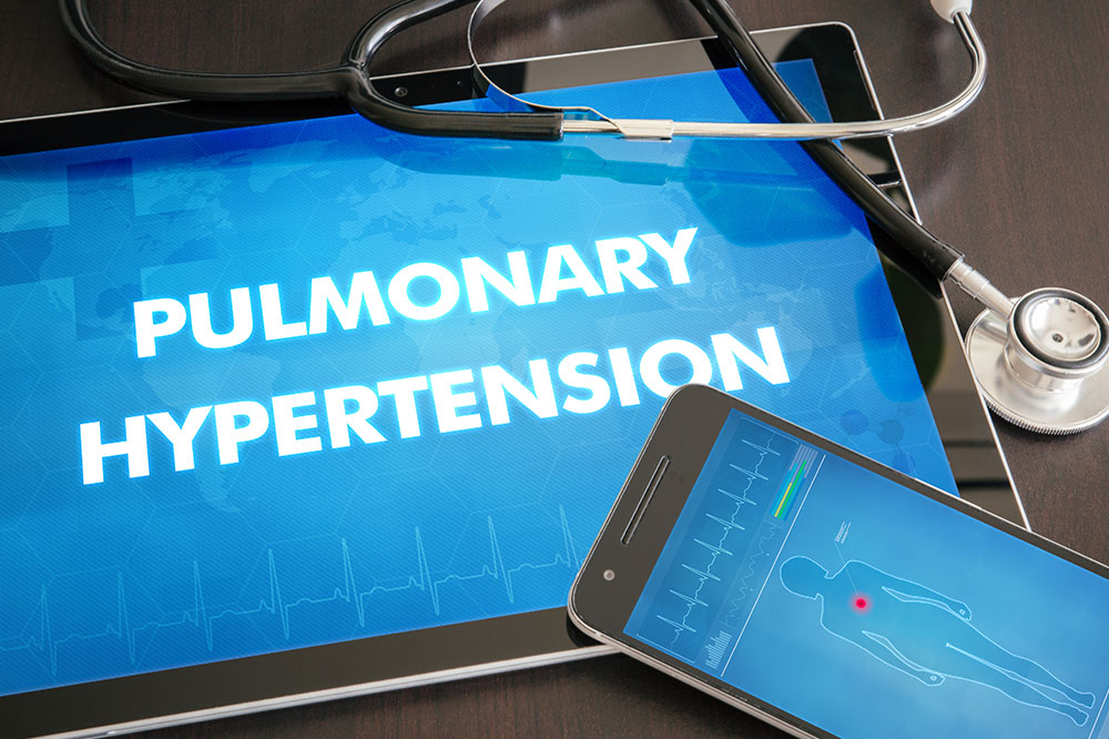 Effective Treatment Options For PAH