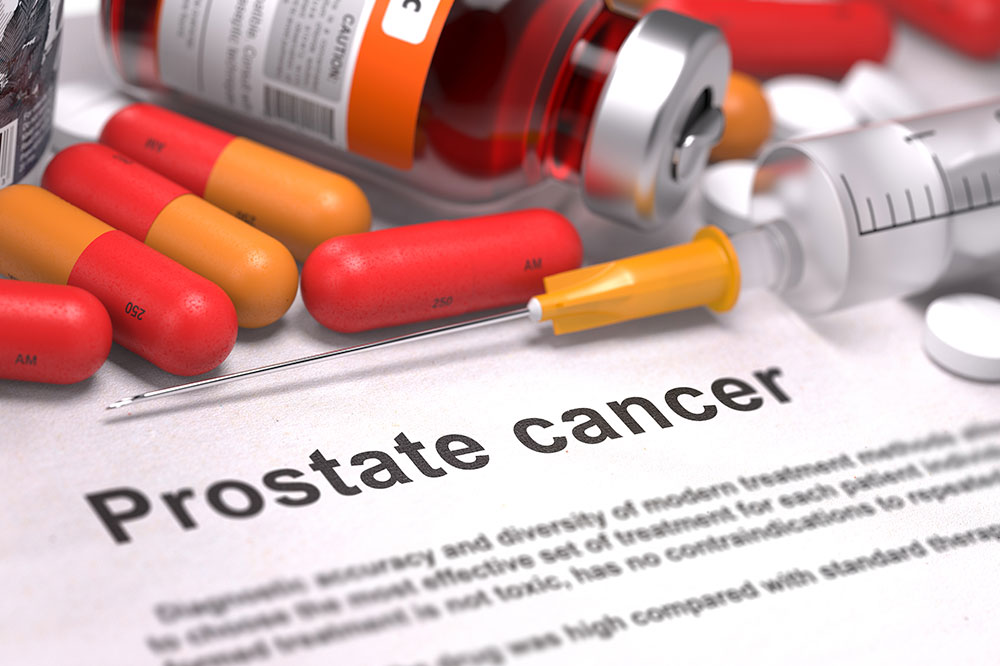 How Are Genetics and Prostate Cancer Related