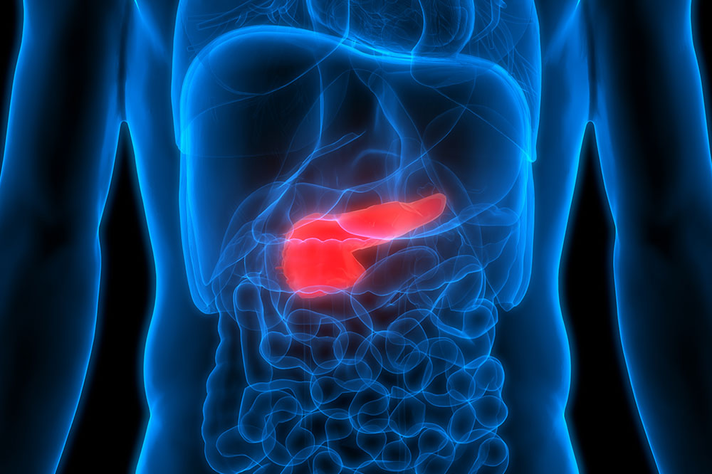 7 Risk Factors for Pancreatic Cancer